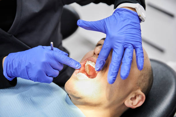 Best Chipped Tooth Repair Near Me  in Owingsville, KY